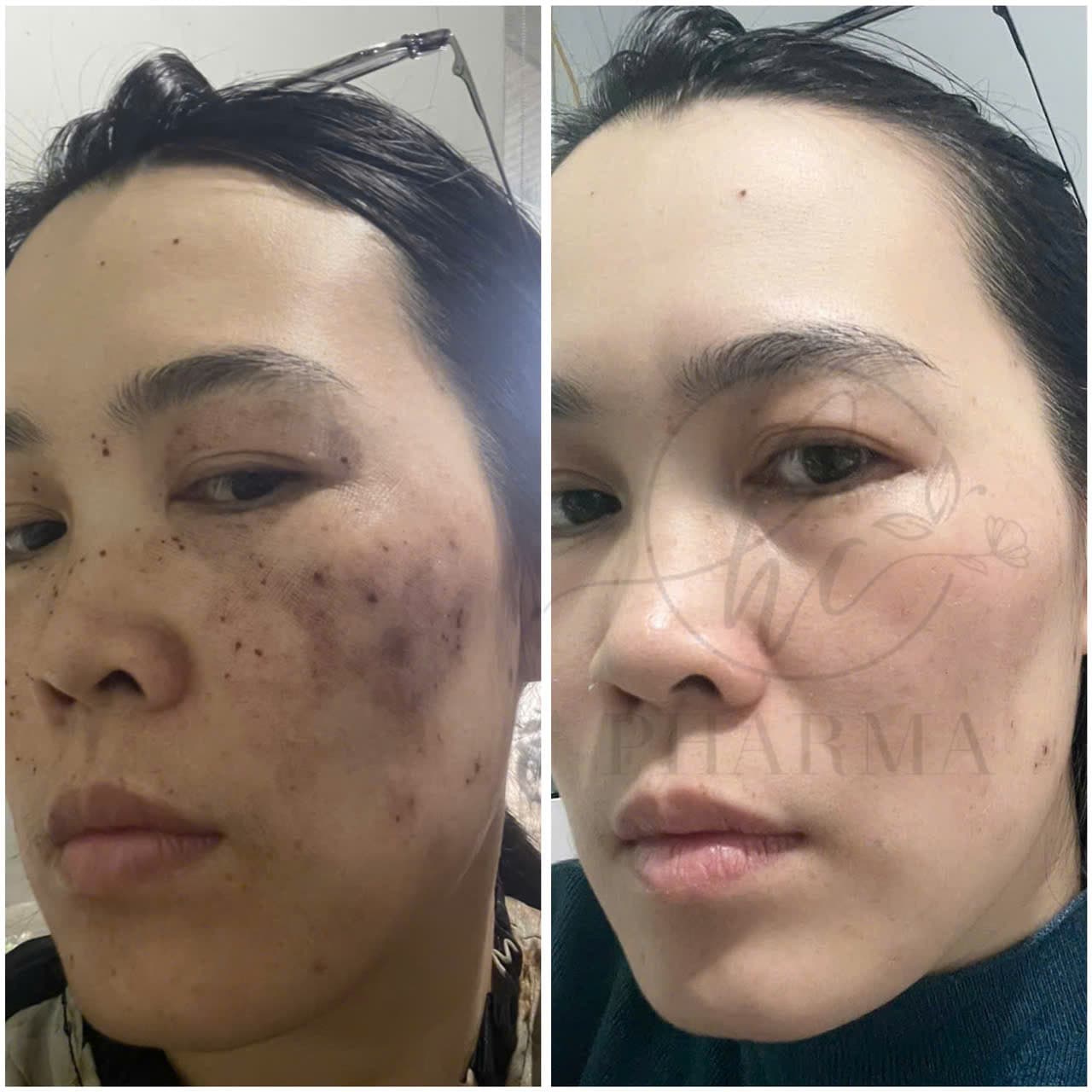 Hình ảnh kết quả 001