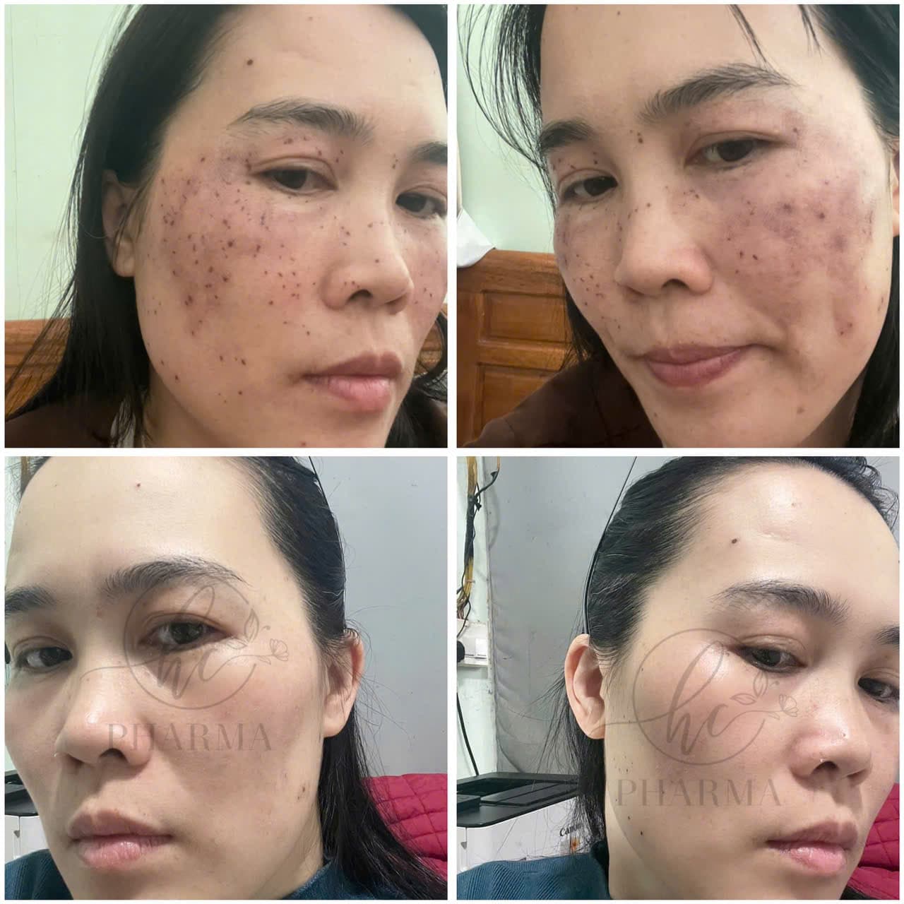 Hình ảnh kết quả 002