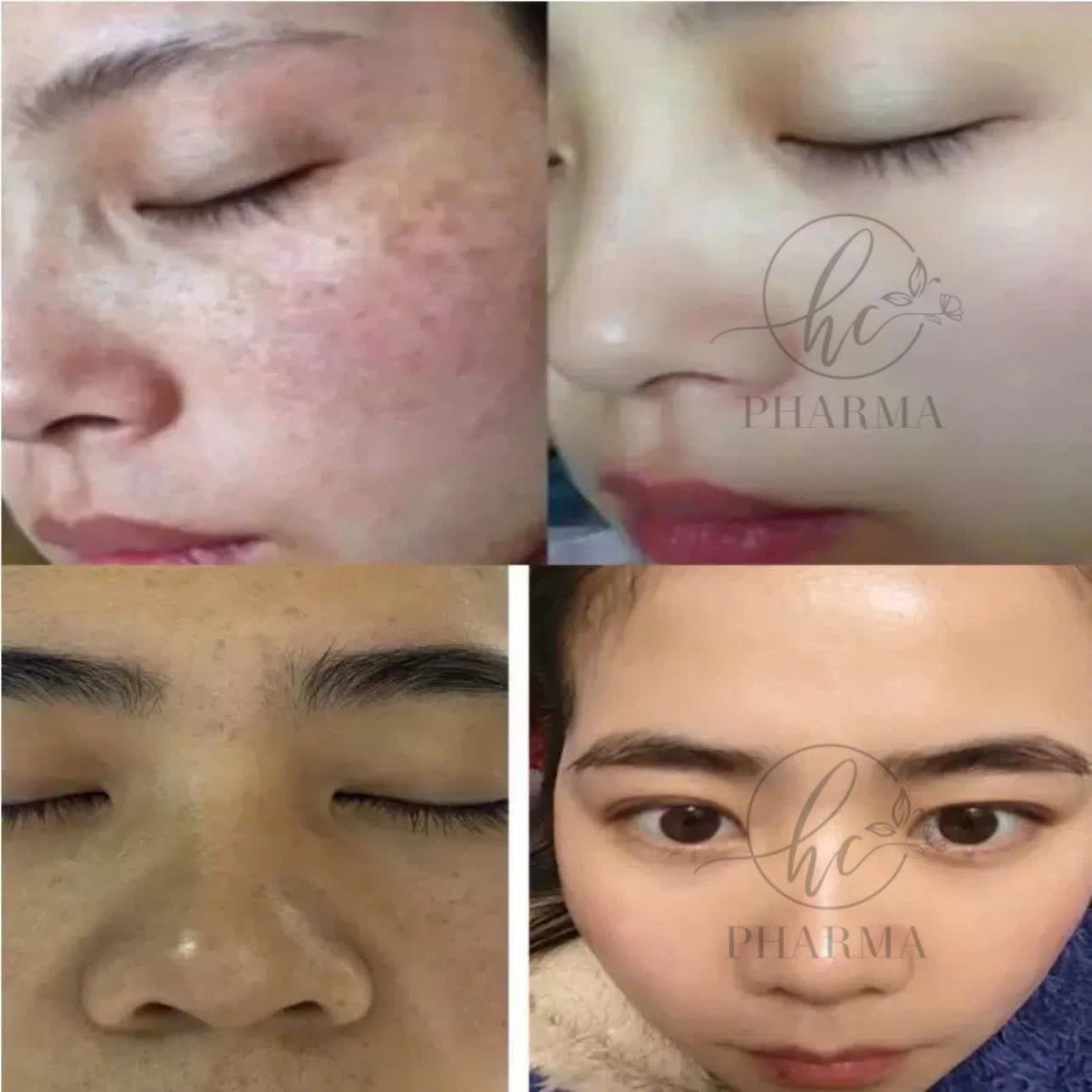 Hình ảnh kết quả 005