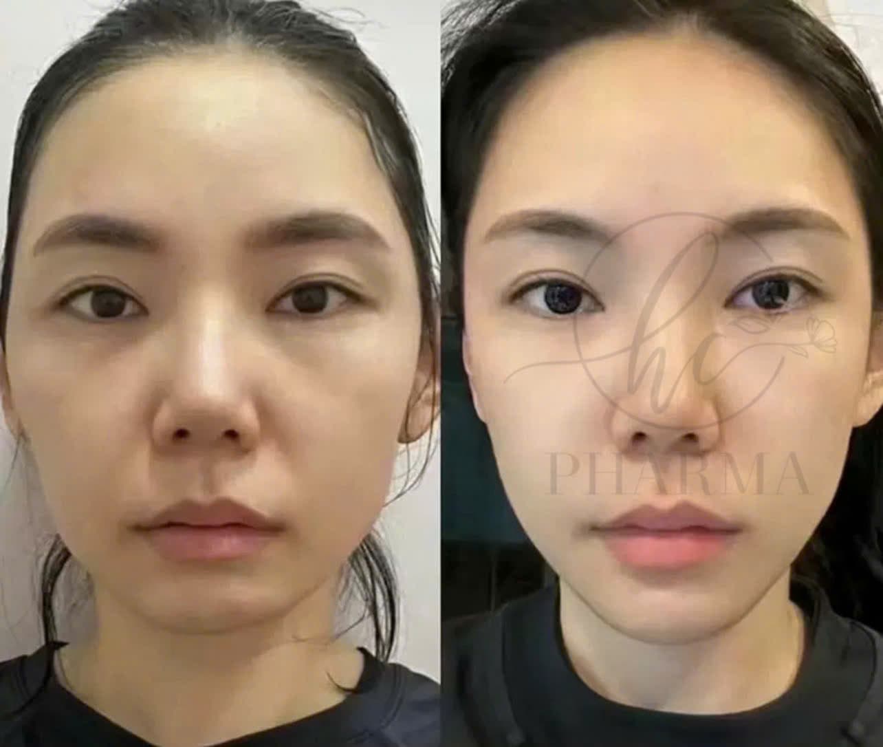 Hình ảnh kết quả 006