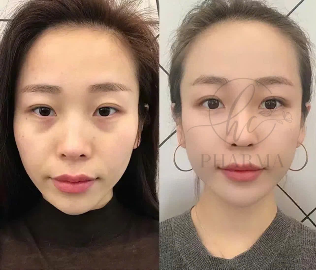Hình ảnh kết quả 008