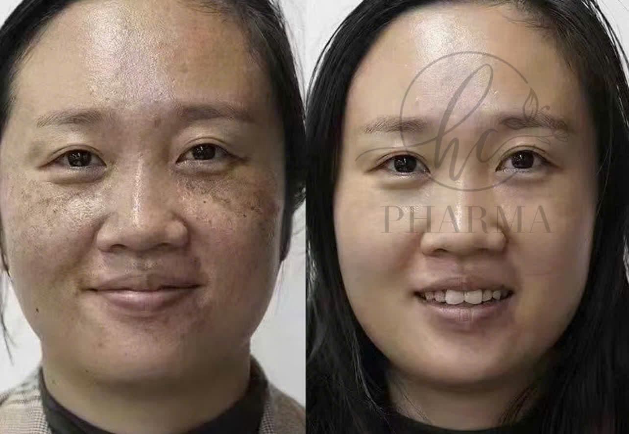 Hình ảnh kết quả 010