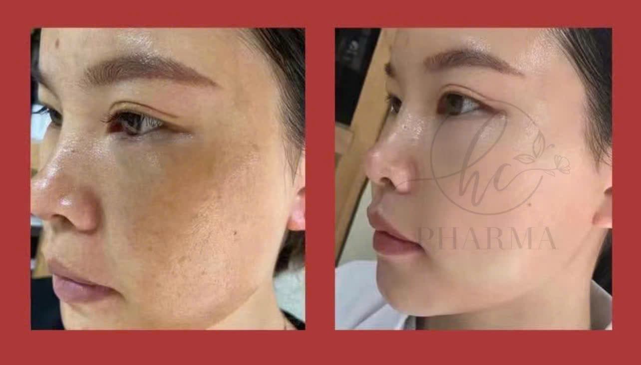 Hình ảnh kết quả 011