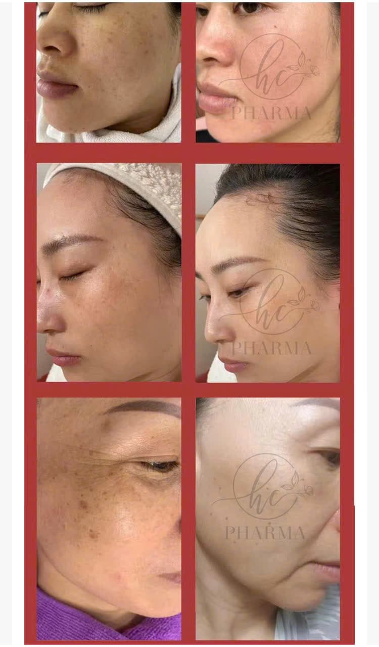Hình ảnh kết quả 012