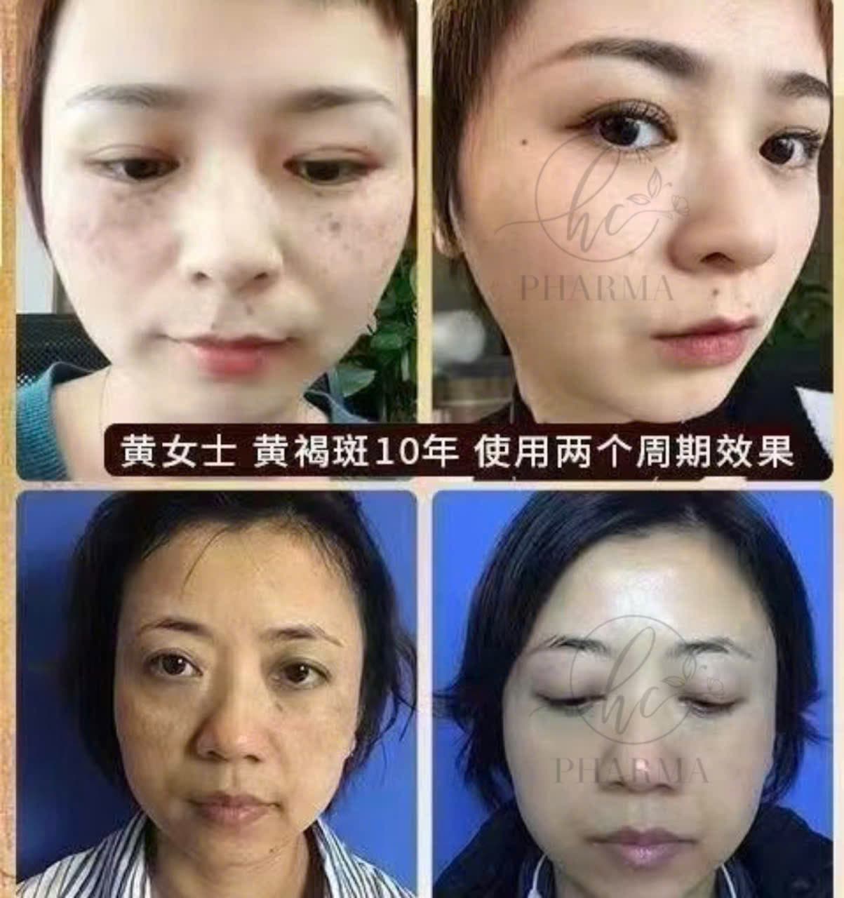 Hình ảnh kết quả 013
