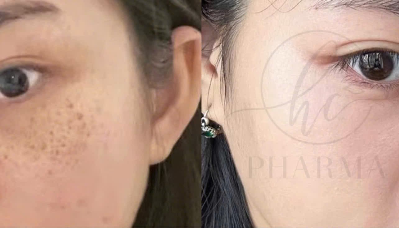 Hình ảnh kết quả 015
