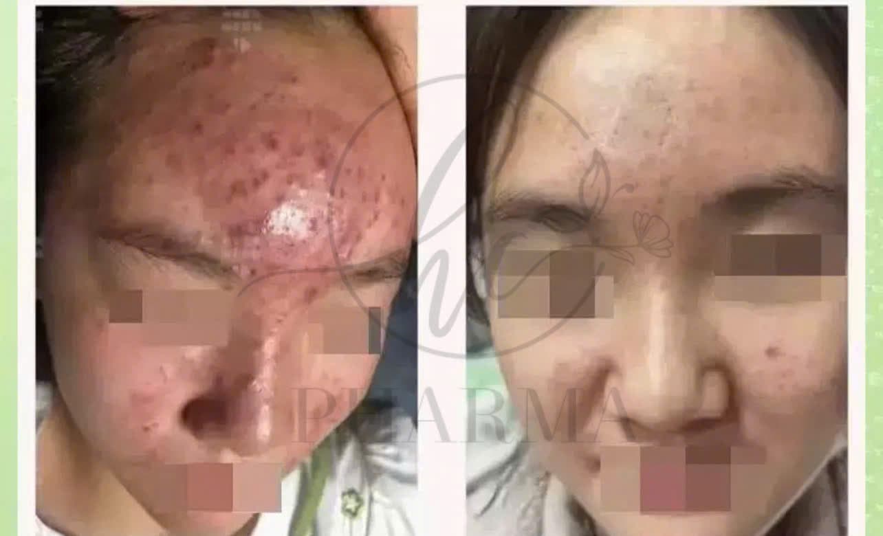 Hình ảnh kết quả 019