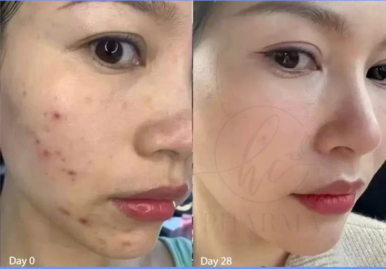 Hình ảnh kết quả 020
