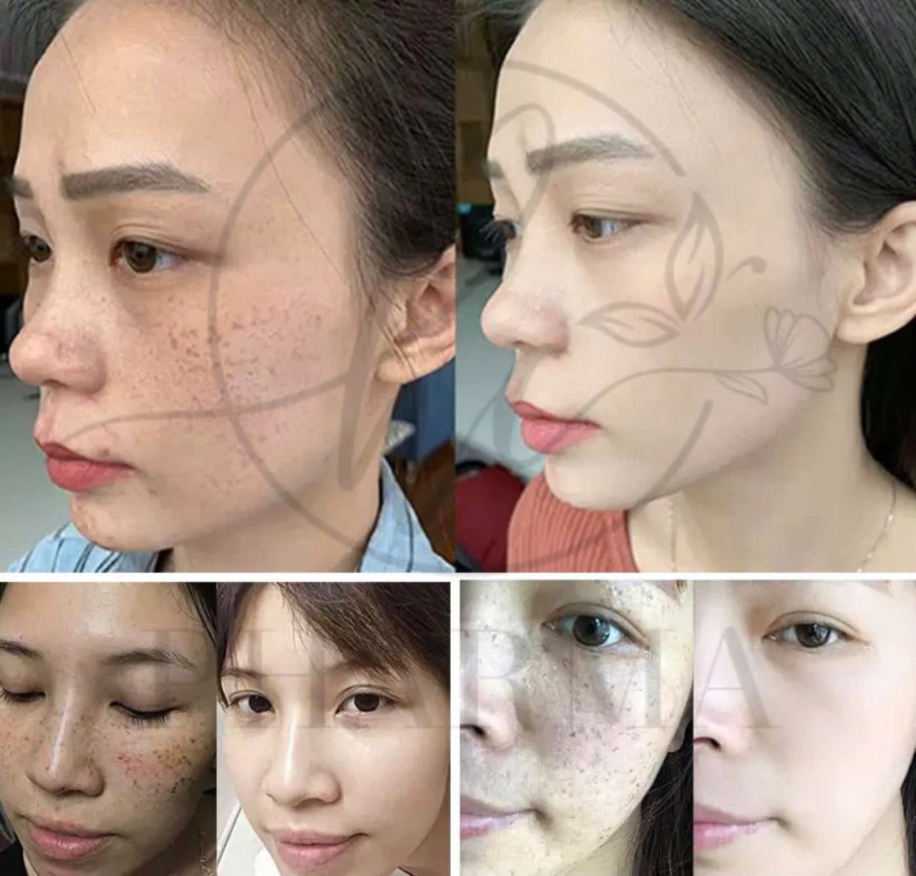 Hình ảnh kết quả 022