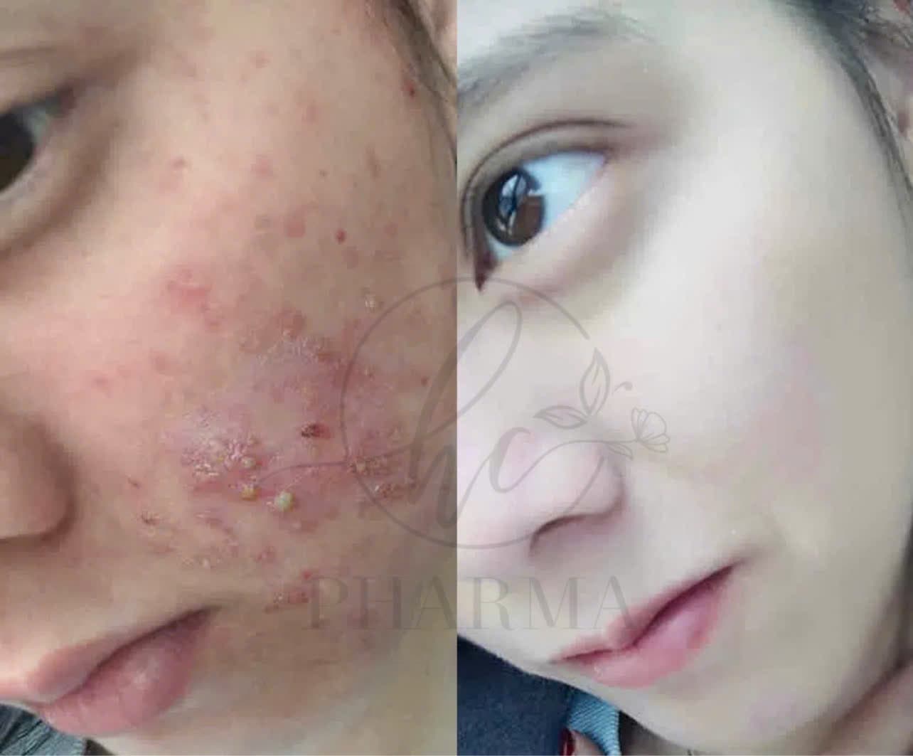 Hình ảnh kết quả 024