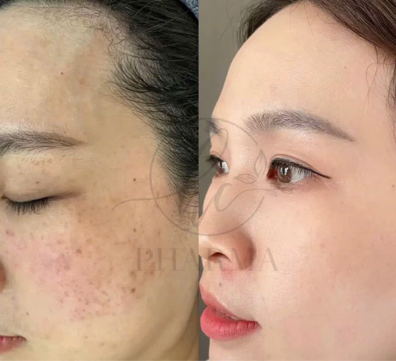 Hình ảnh kết quả 025