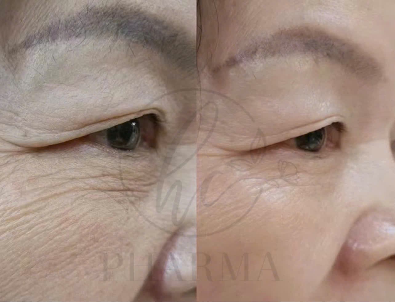 Hình ảnh kết quả 026