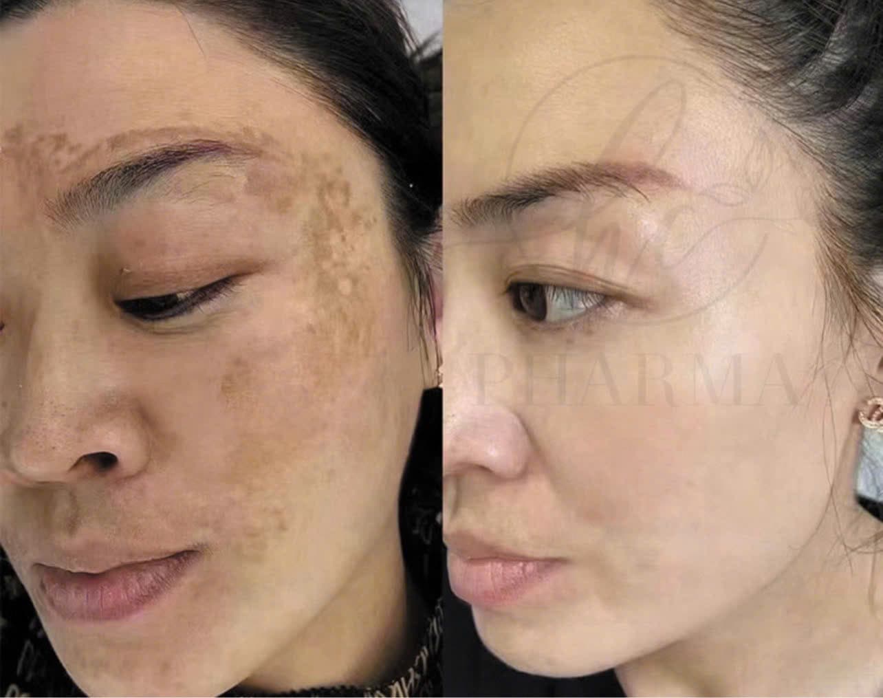 Hình ảnh kết quả 028