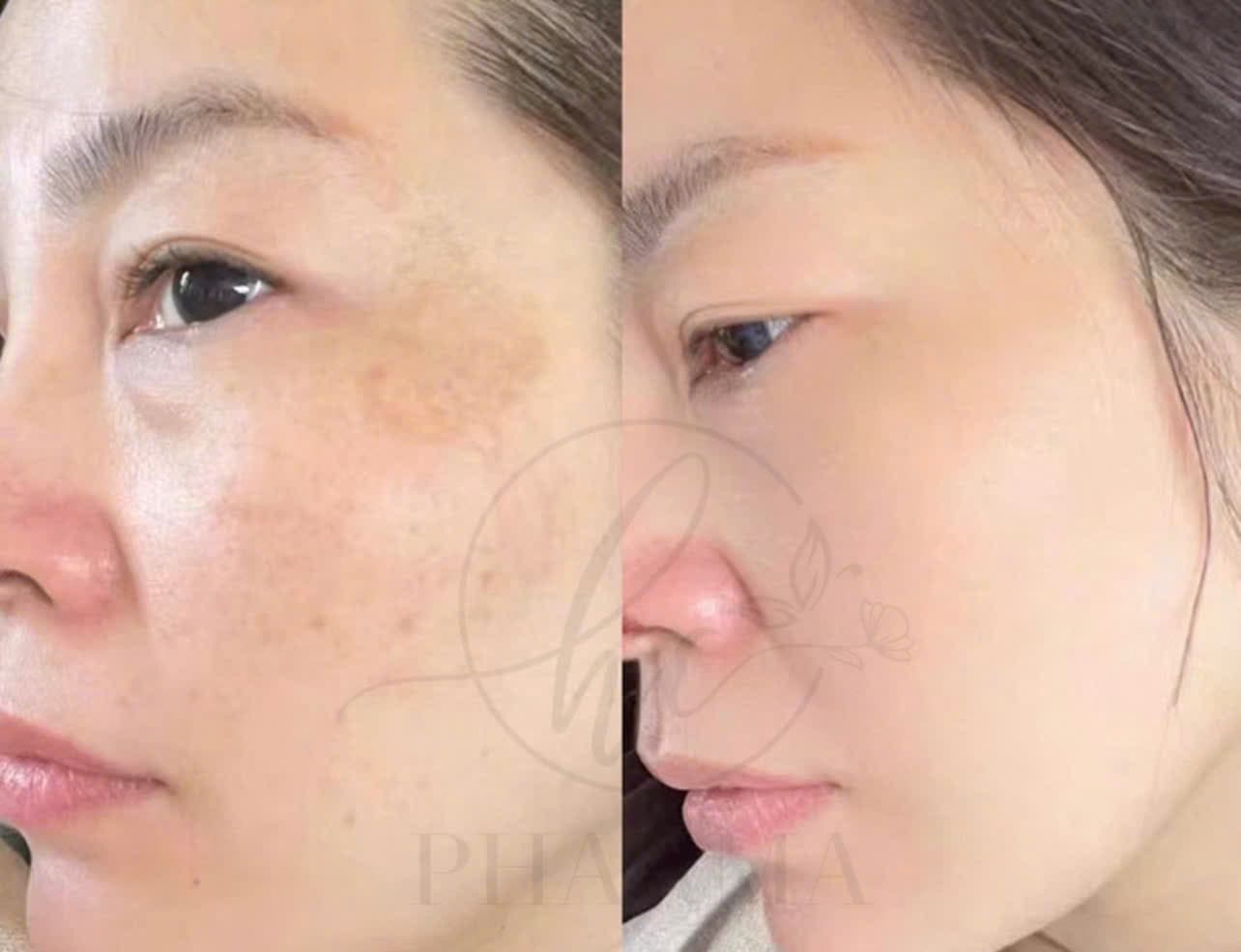 Hình ảnh kết quả 029