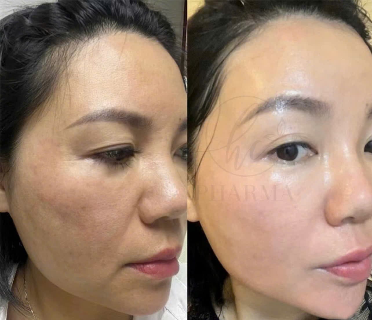 Hình ảnh kết quả 030