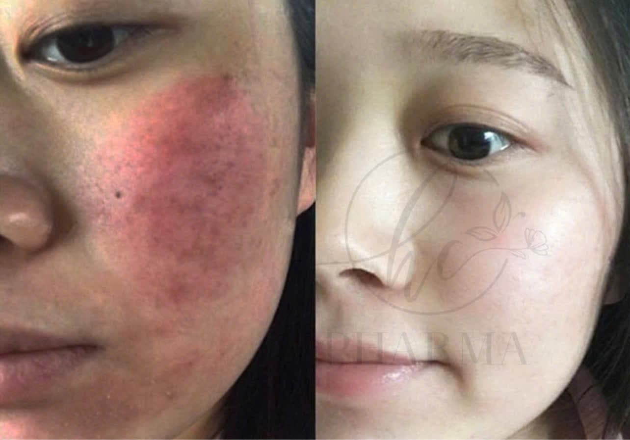 Hình ảnh kết quả 032