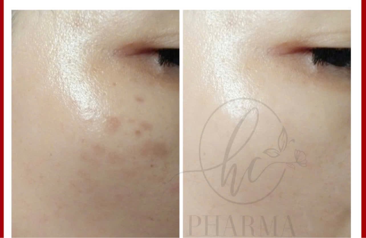 Hình ảnh kết quả 033