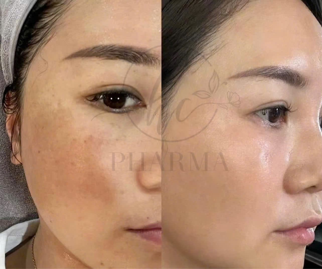 Hình ảnh kết quả 034