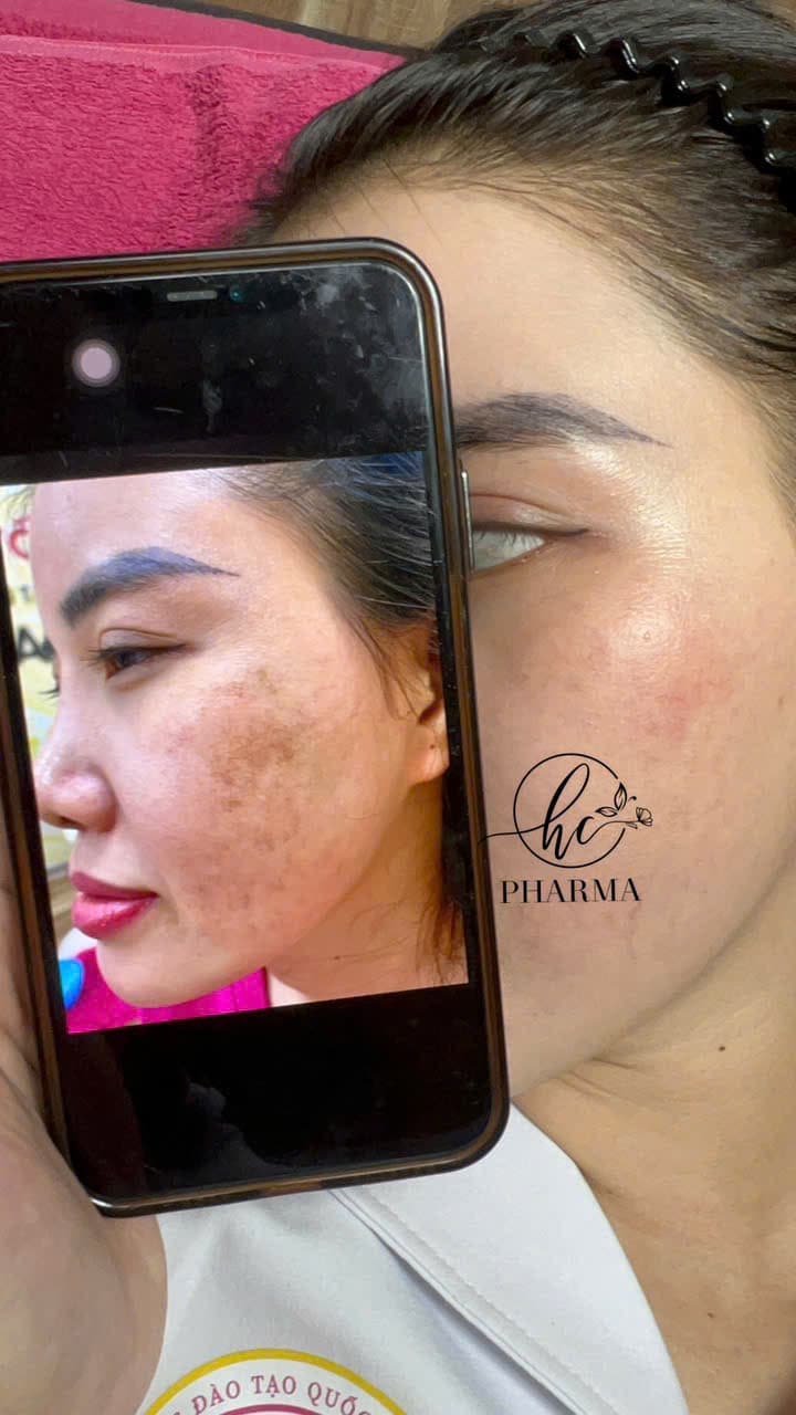 Hình ảnh kết quả 036