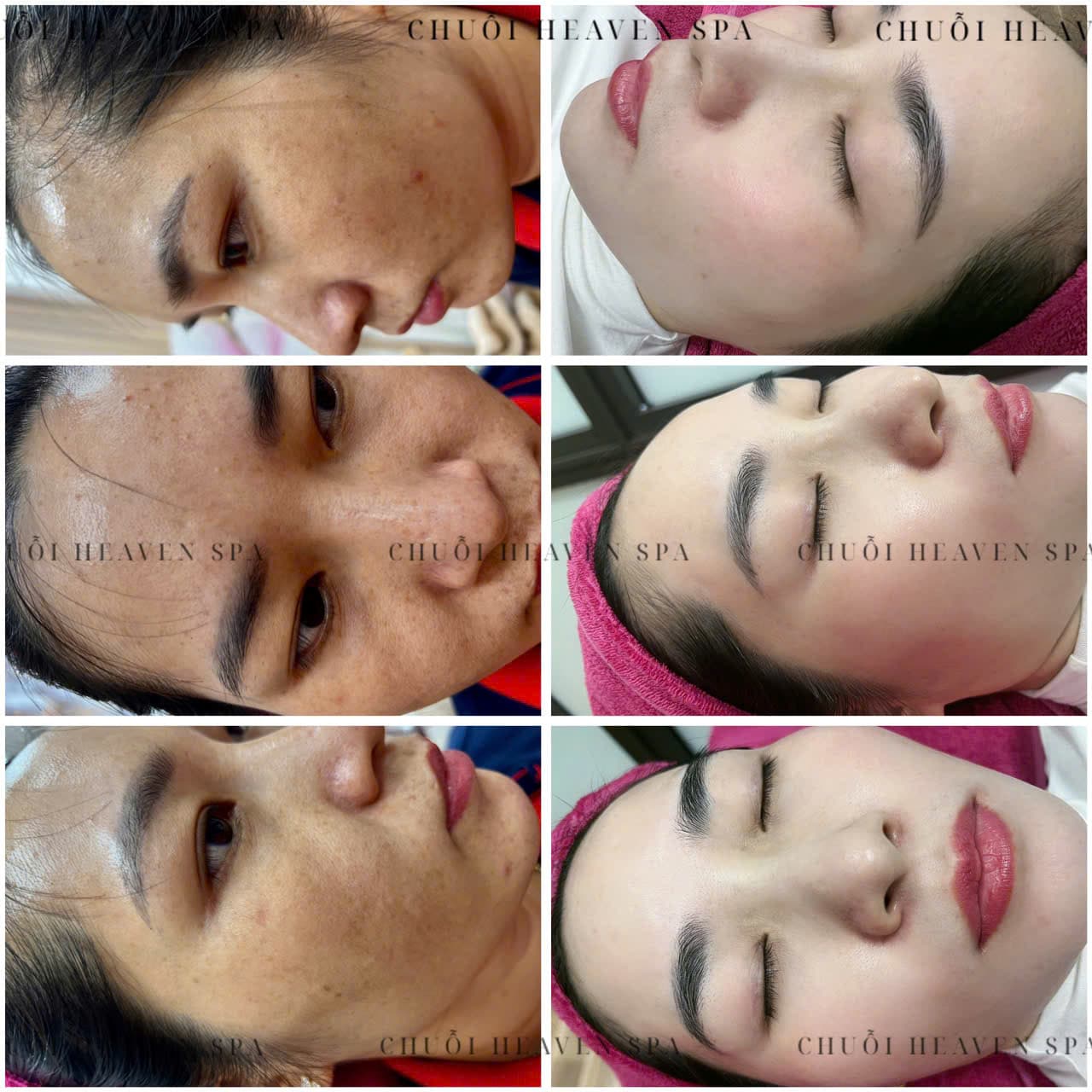 Hình ảnh kết quả 037