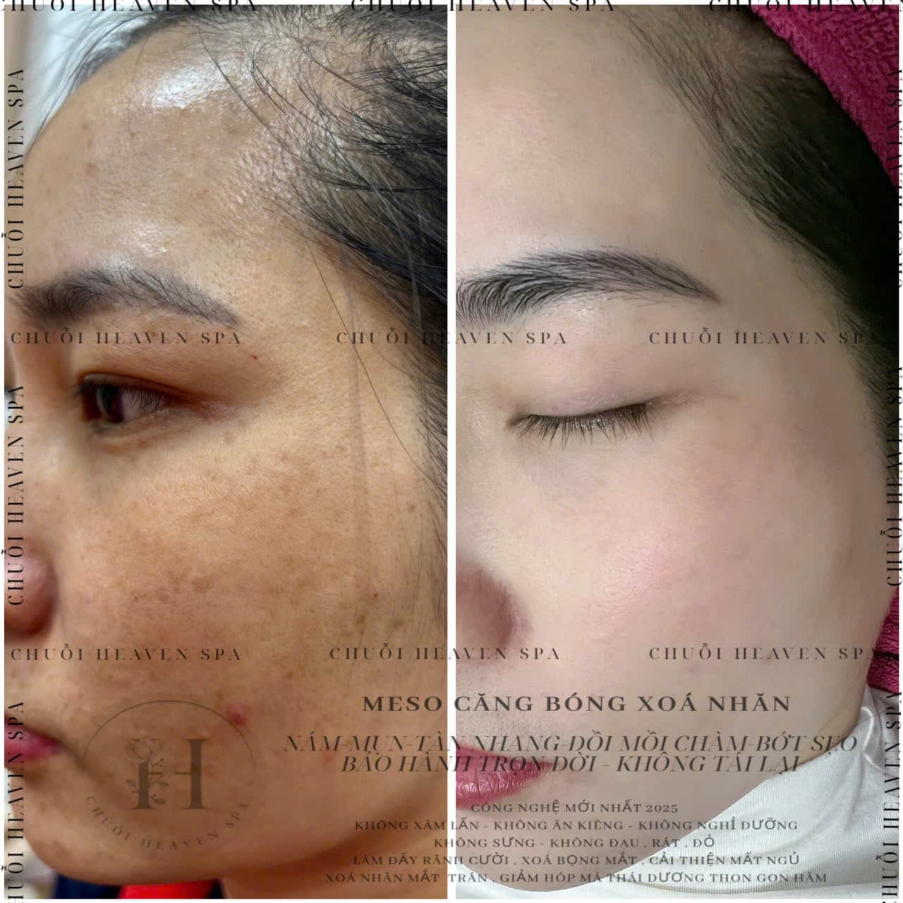 Hình ảnh kết quả 038