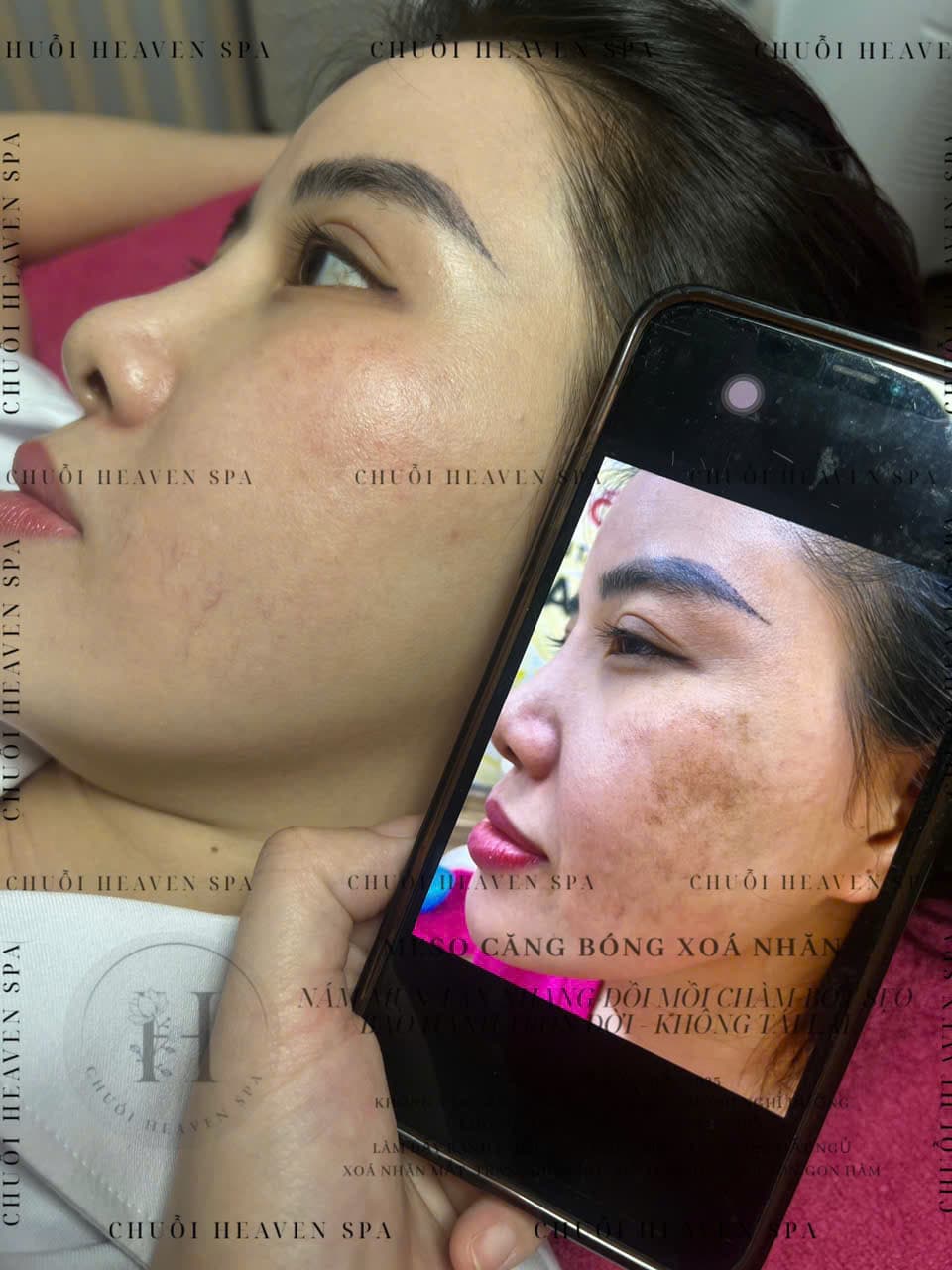 Hình ảnh kết quả 039