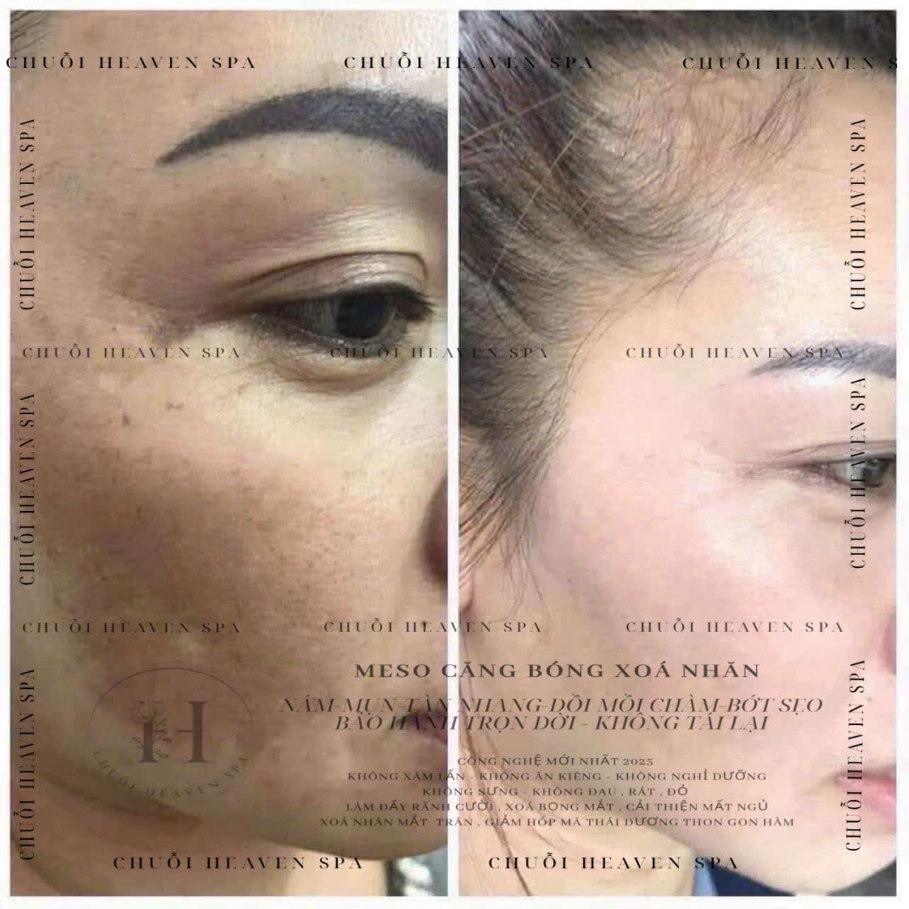 Hình ảnh kết quả 040