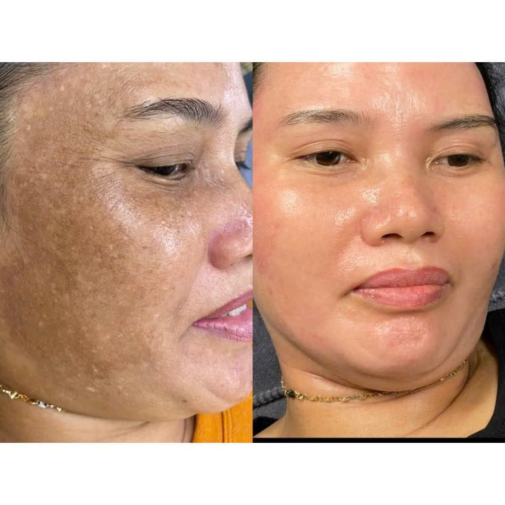 Hình ảnh kết quả 041