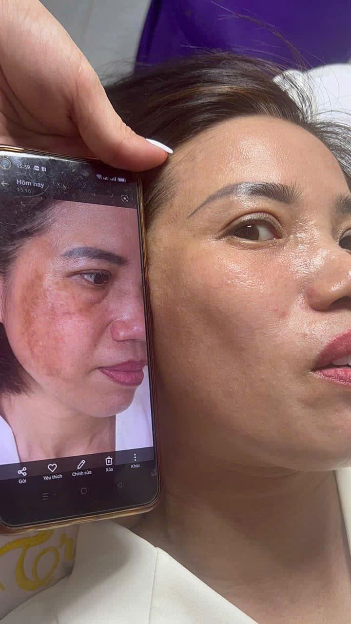 Hình ảnh kết quả 044