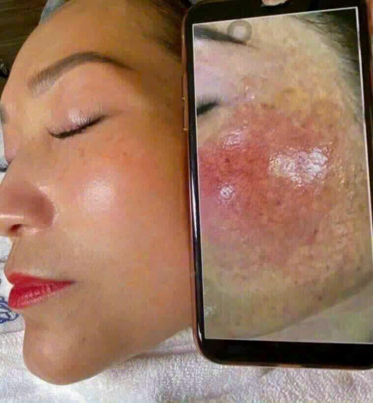 Hình ảnh kết quả 045