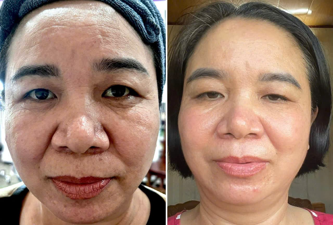 Hình ảnh kết quả 046