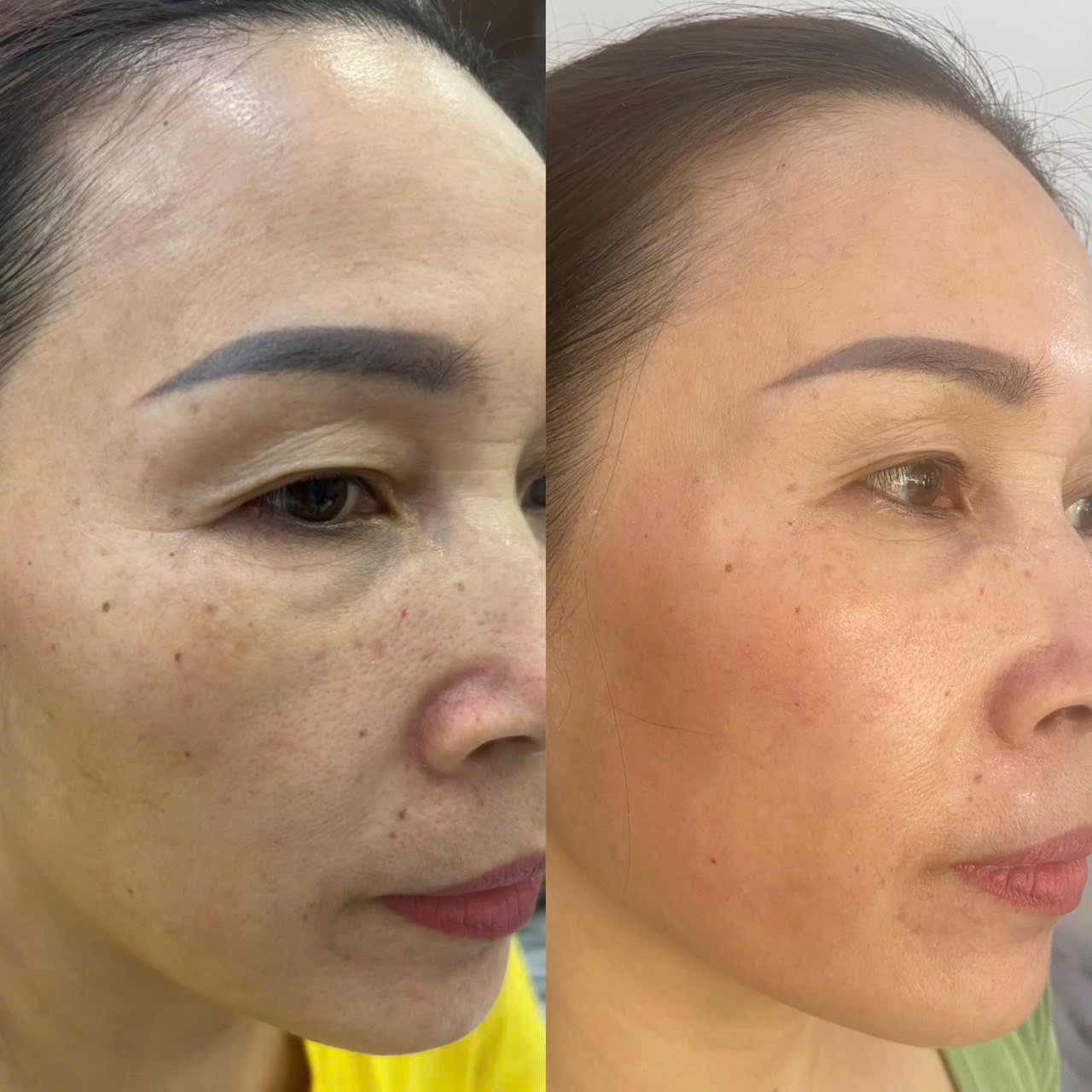 Hình ảnh kết quả 047