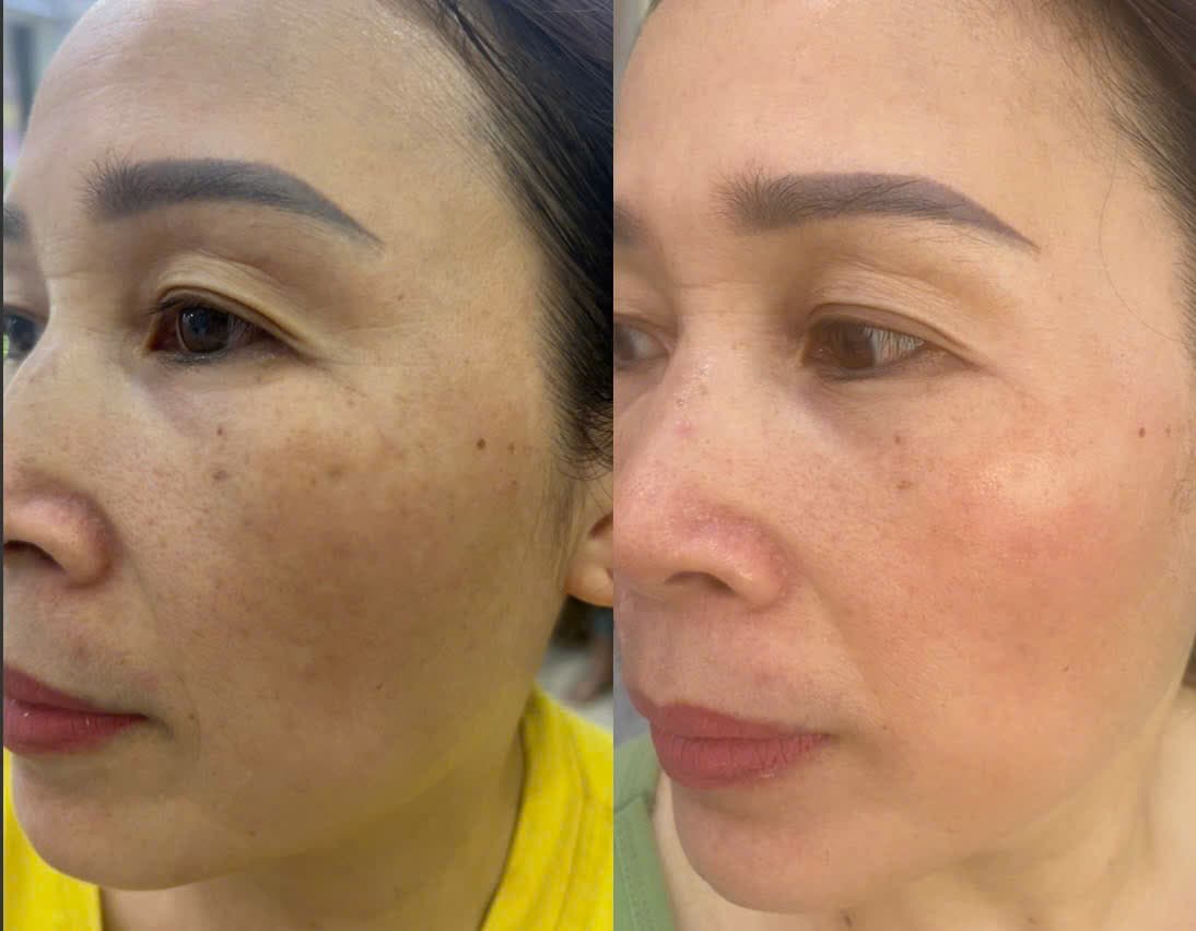 Hình ảnh kết quả 048