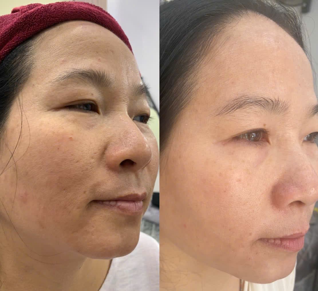 Hình ảnh kết quả 049