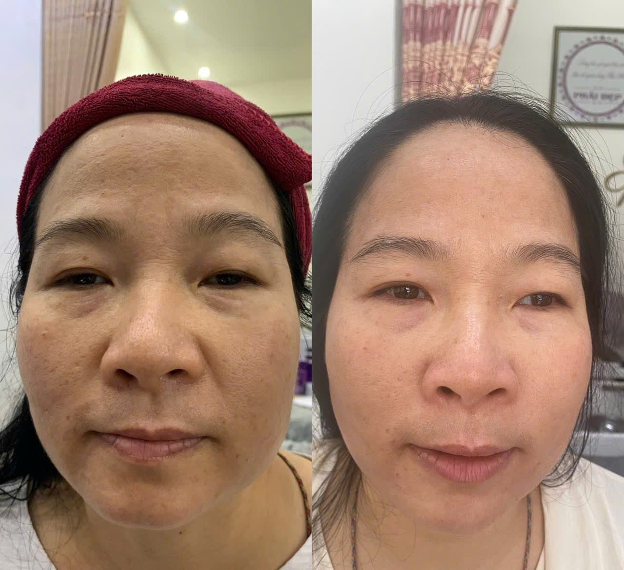 Hình ảnh kết quả 050