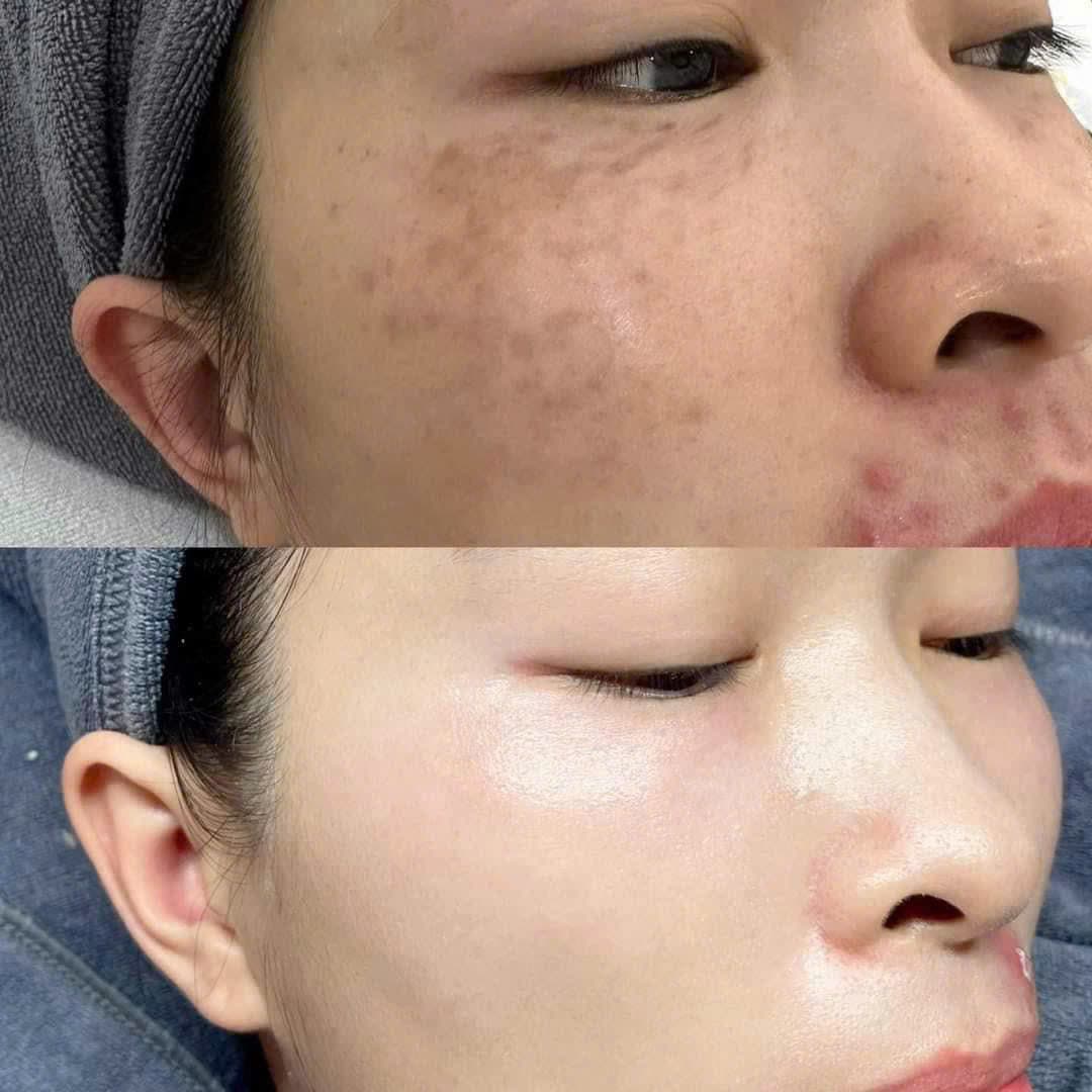 Hình ảnh kết quả 051