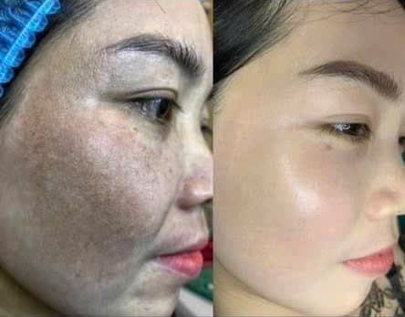 Hình ảnh kết quả 052