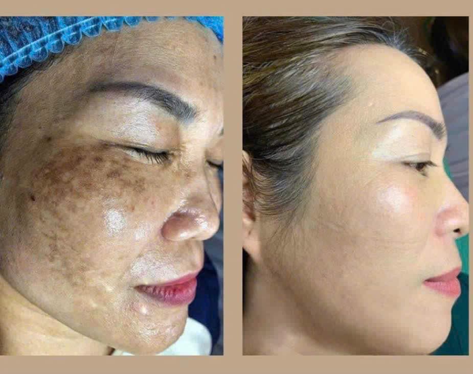 Hình ảnh kết quả 054