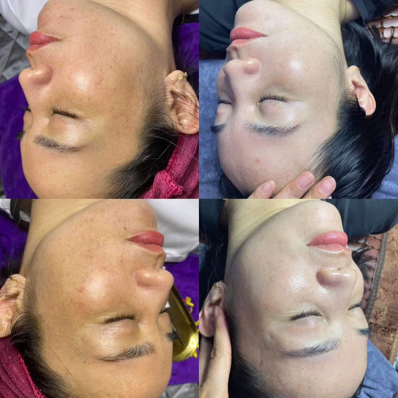 Hình ảnh kết quả 055