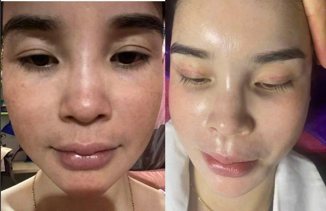 Hình ảnh kết quả 056