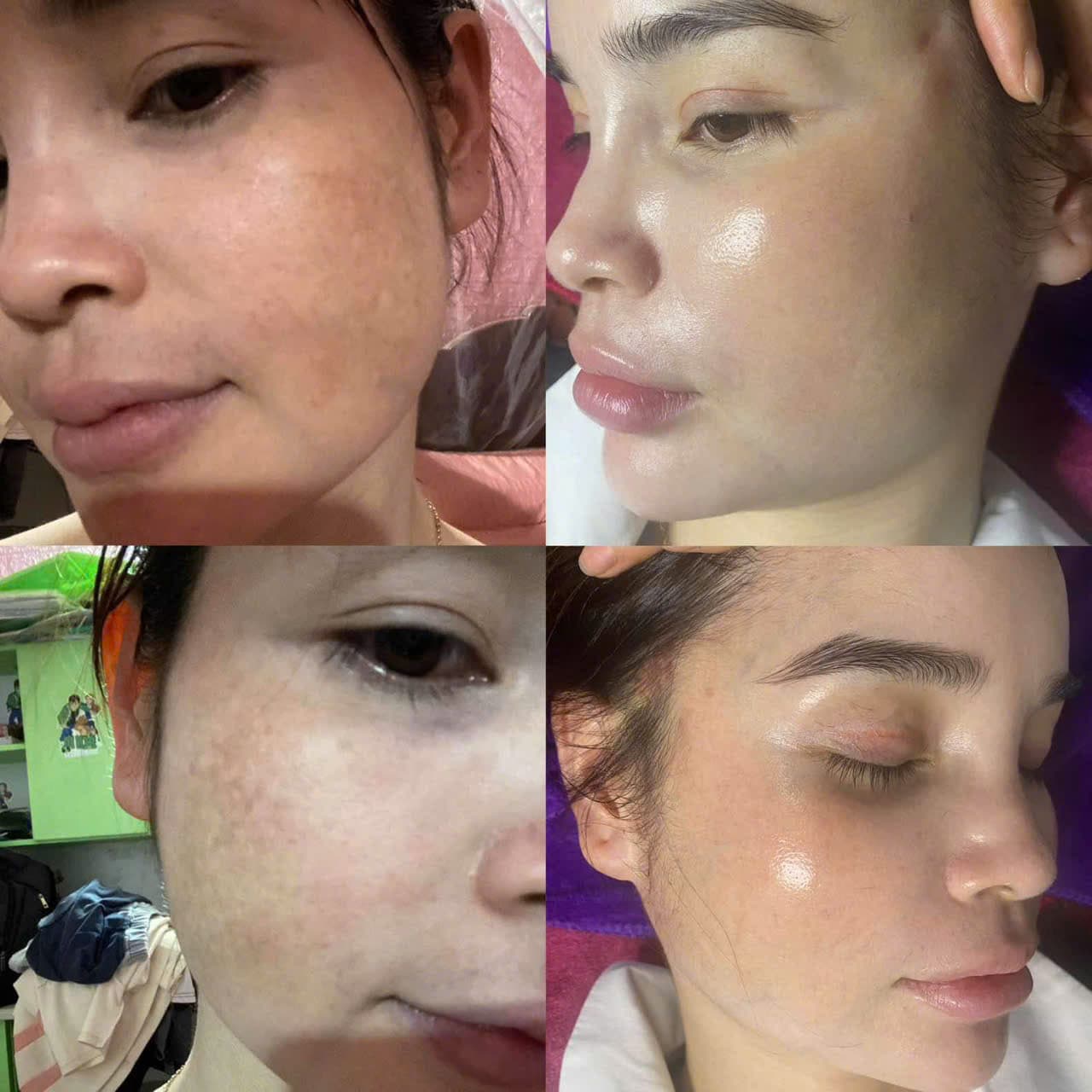 Hình ảnh kết quả 057