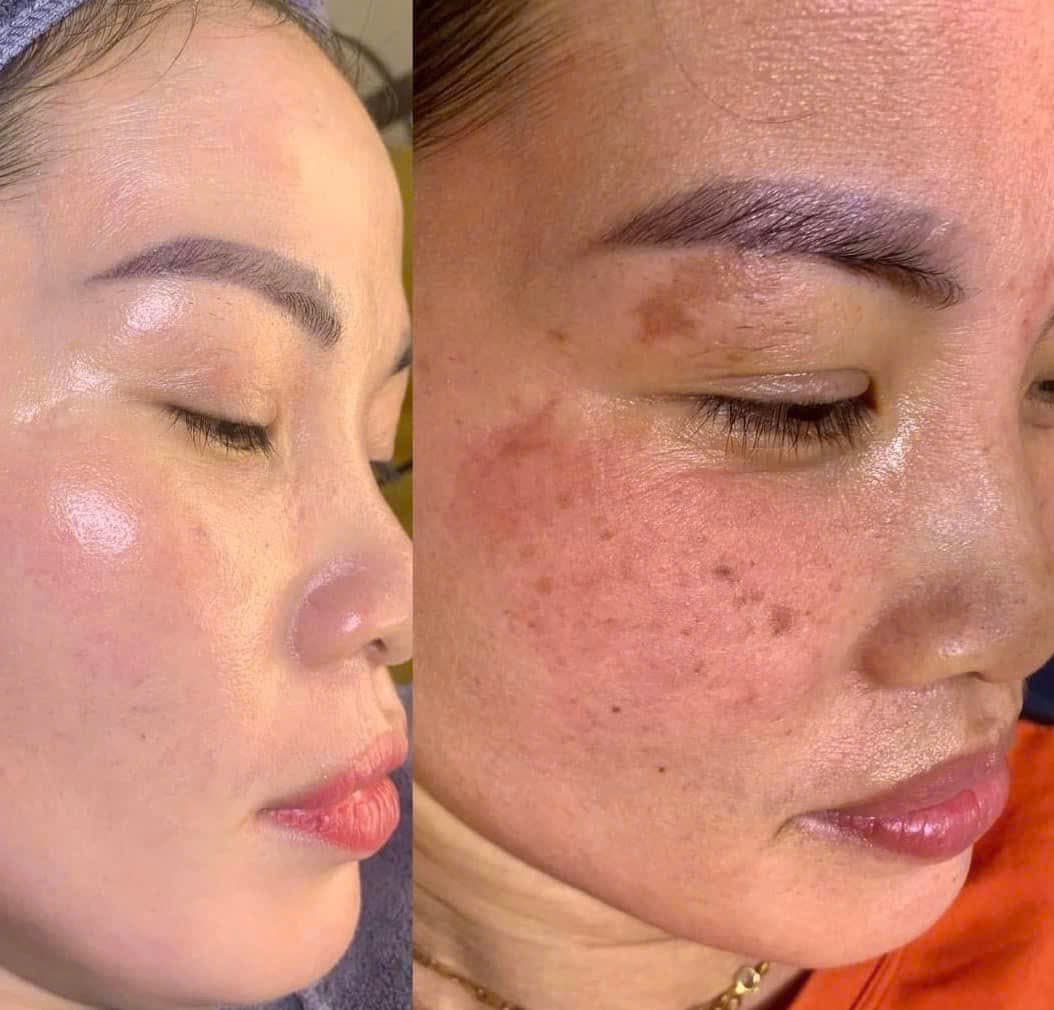 Hình ảnh kết quả 058