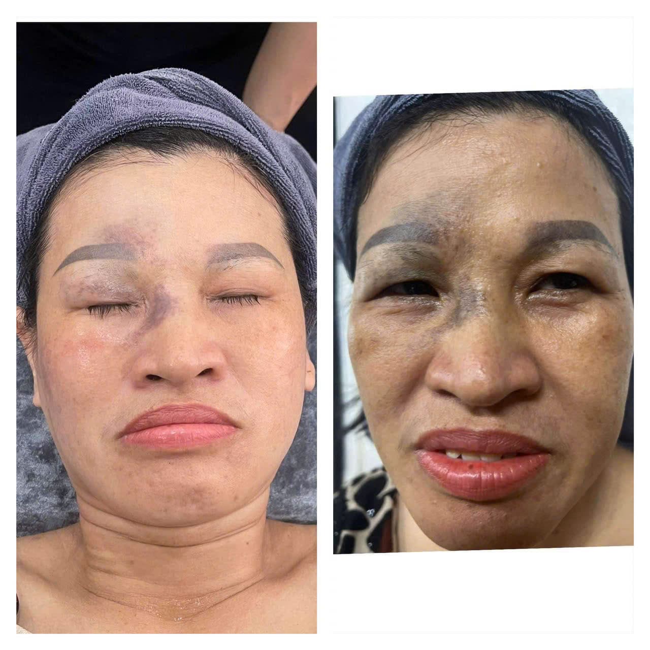 Hình ảnh kết quả 059