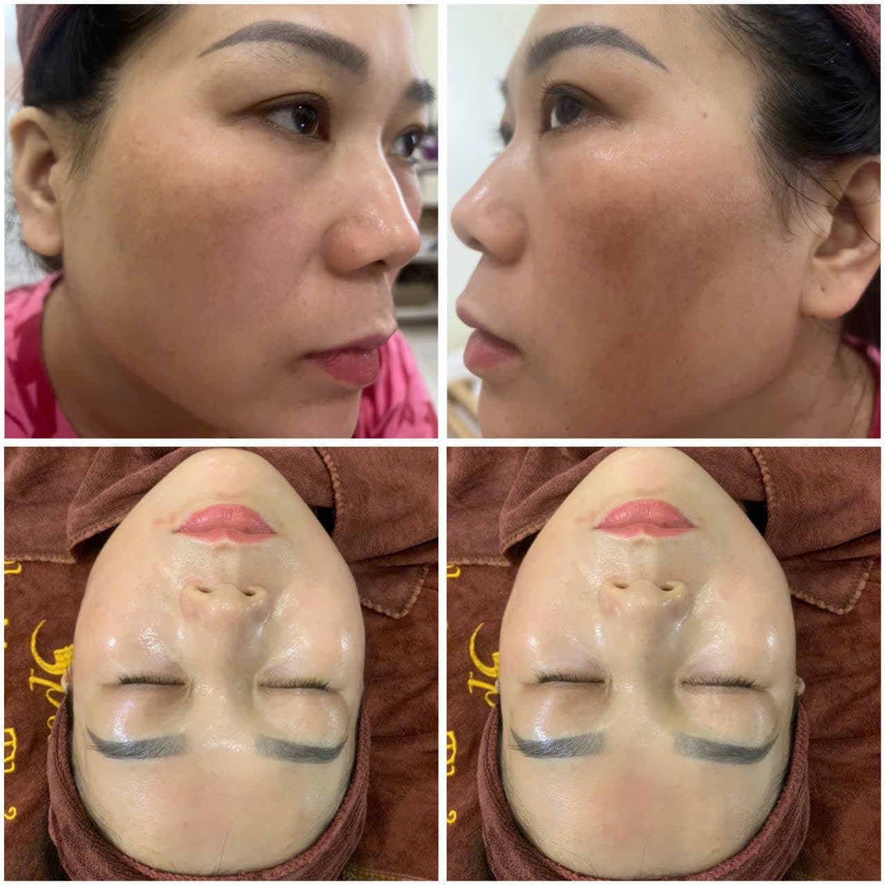 Hình ảnh kết quả 060