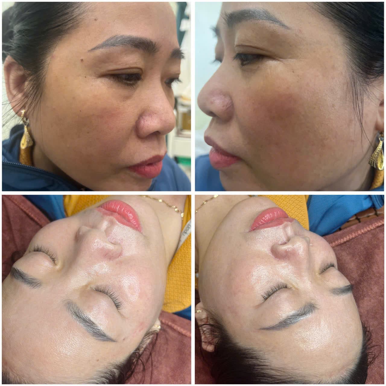 Hình ảnh kết quả 061