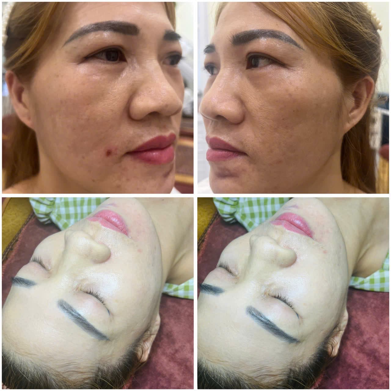 Hình ảnh kết quả 062