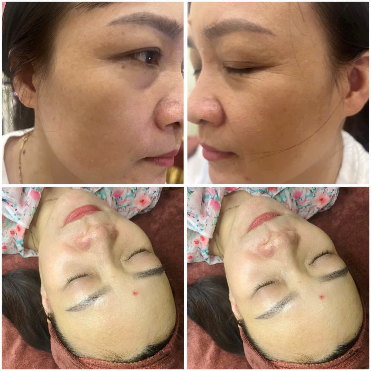 Hình ảnh kết quả 063