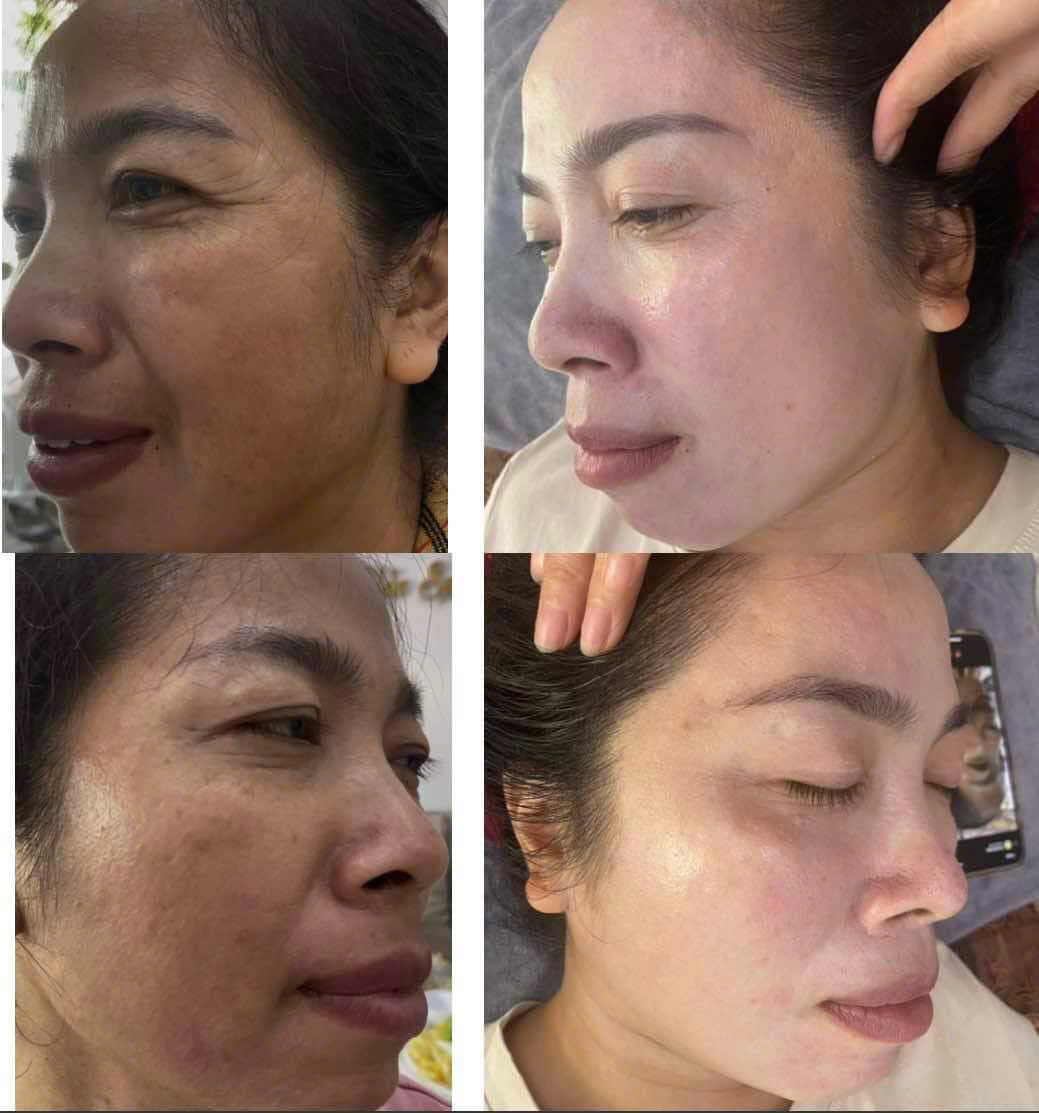Hình ảnh kết quả 066