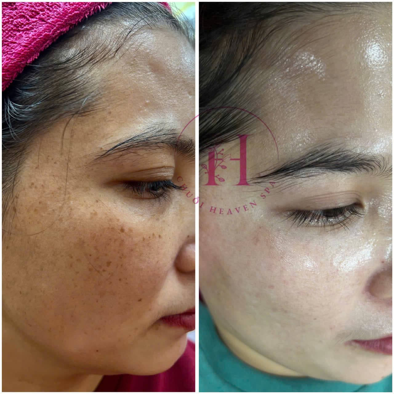 Hình ảnh kết quả 068