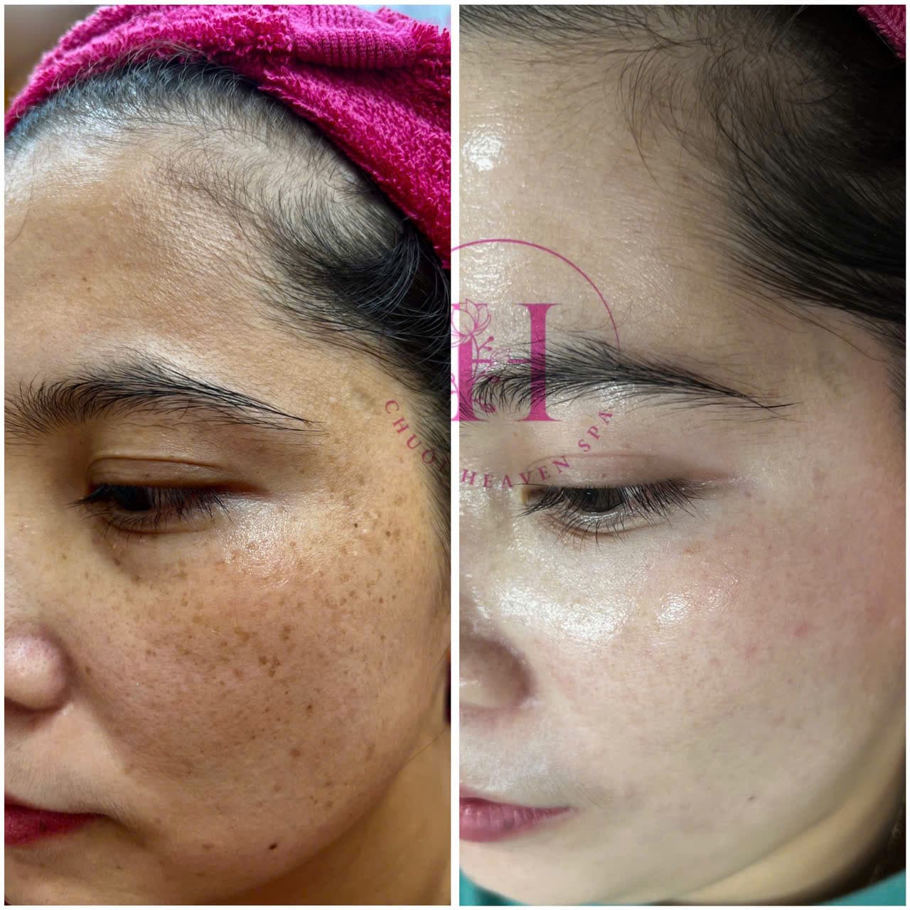 Hình ảnh kết quả 069
